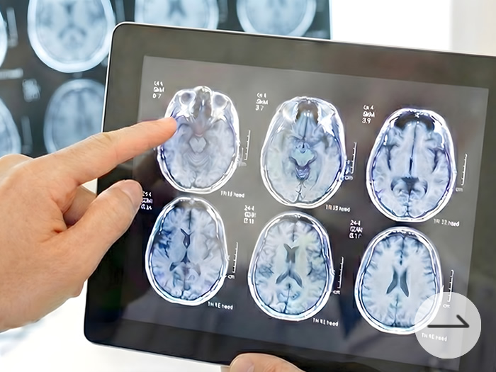 専門医3名による高精度の読影を詳しく見る